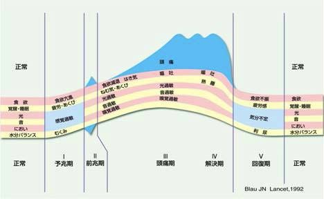 片頭痛発作の経過