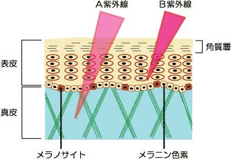 紫外線の種類